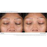 Extra Strength Active Peel Brightening System