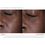 Extra Strength Active Peel Brightening System