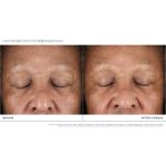 Extra Strength Active Peel Brightening System